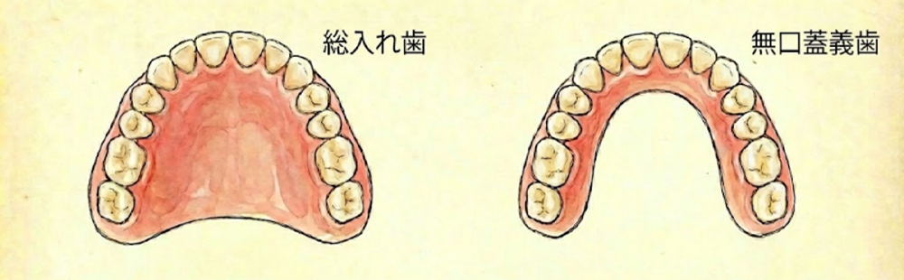 入れ歯