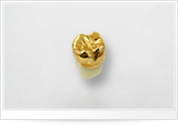 オールセラミック