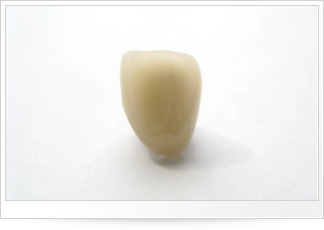 オールセラミック