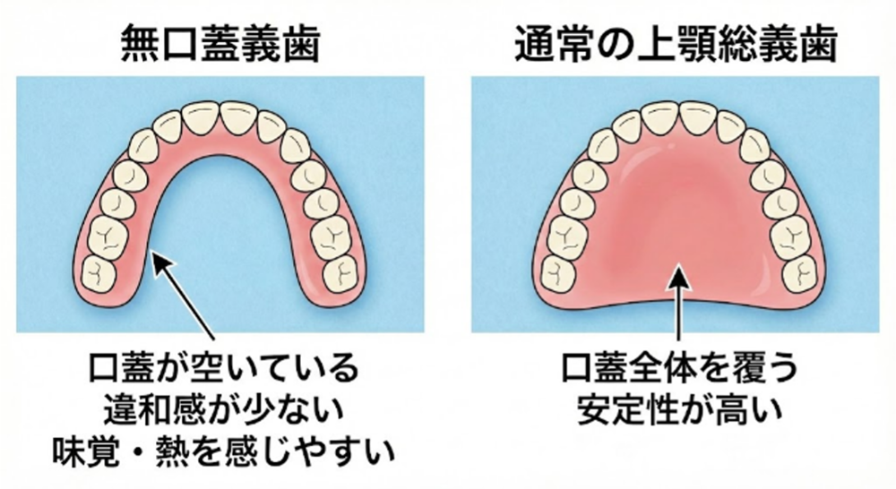 入れ歯