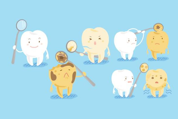 6歳臼歯は虫歯になりやすい！